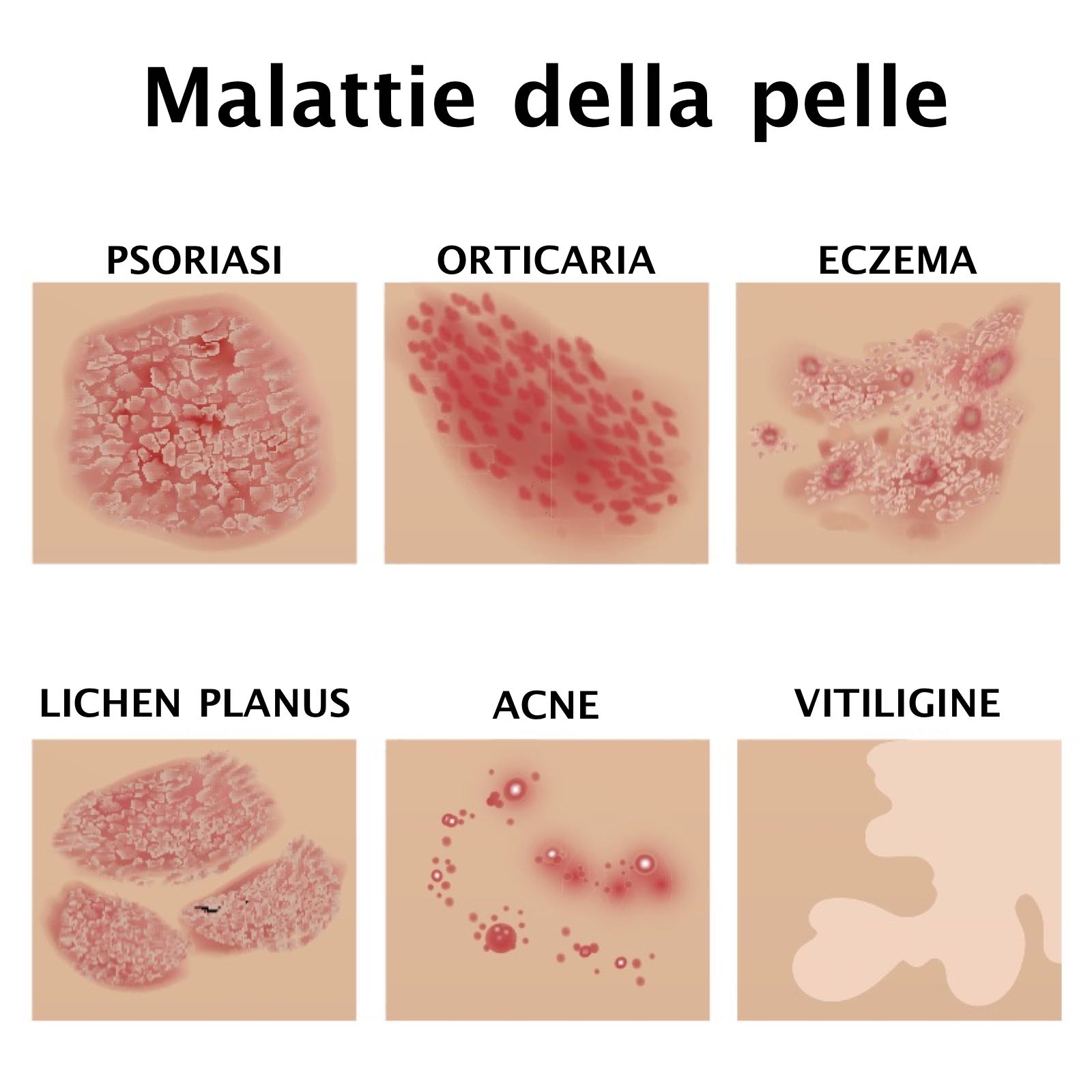 Dermatosi Dermatosi