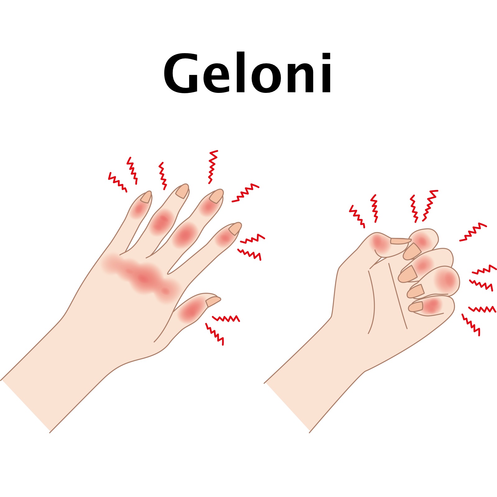 Geloni